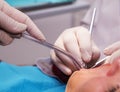 DentistÃ¢â¬â¢s hands with tools making hygiene in a patient`s mouth